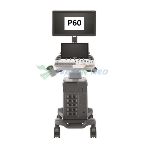 Appareil d'échographie Doppler couleur mobile Sonoscape P60