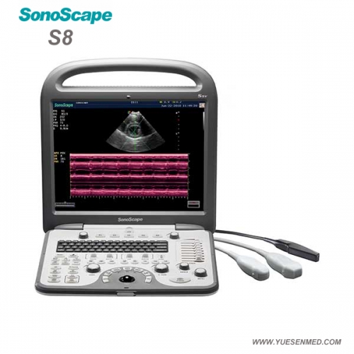 Échographe Doppler couleur portable Sonoscape S8 S8