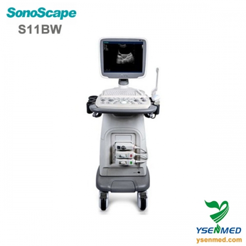 SonoScape S11BW chariot scanner à ultrasons noir et blanc