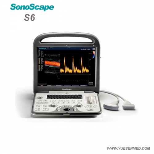 SonoScape S6 Échographe Doppler couleur portable S6