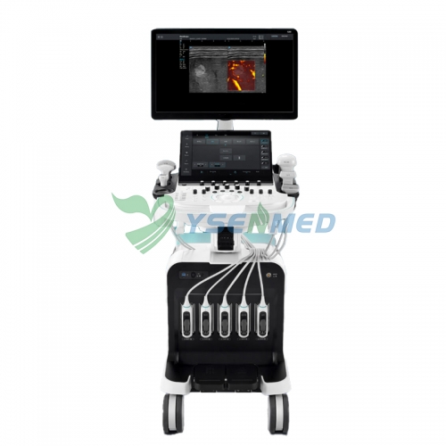 Système d'échographie Doppler couleur SonoScape S80